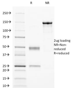 Fc gamma RIIA/CD32a Antibody (8.7), Novus Biologicals:Antibodies:Primary